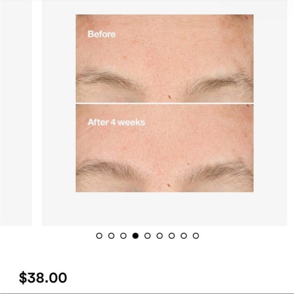 Clinique Clarifying Do Over Peel - 1 oz NEW Exfoliating dry combination to oily - Picture 5 of 9